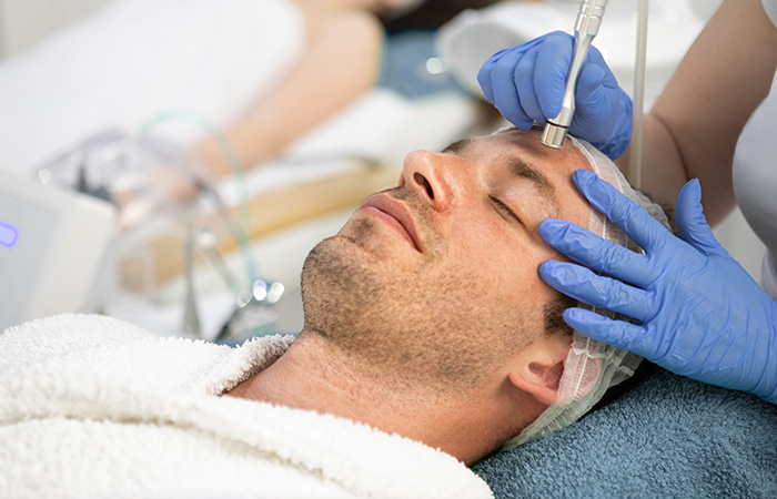 Microdermabrasion | Aesthetics Treatments Oxford gallery image 1